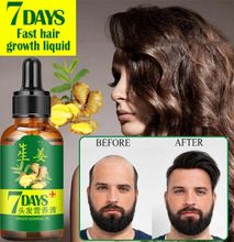 7 Days Germinal Hair Growth Oil